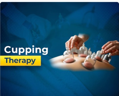 Cupping therapy and myofascial decompression treatment